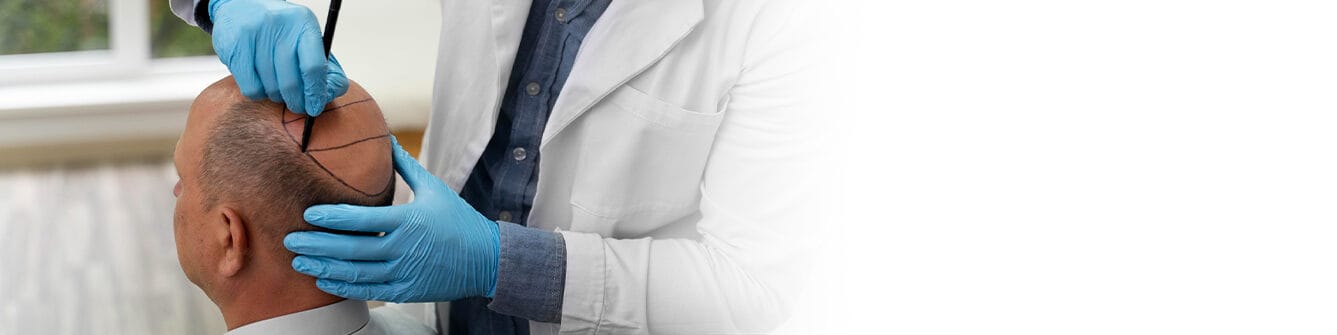 American Academy of Cosmetic Surgery Hospital | FUE زراعة الشعر بتقنية American Academy of Cosmetic Surgery Hospital | FUE زراعة الشعر بتقنية