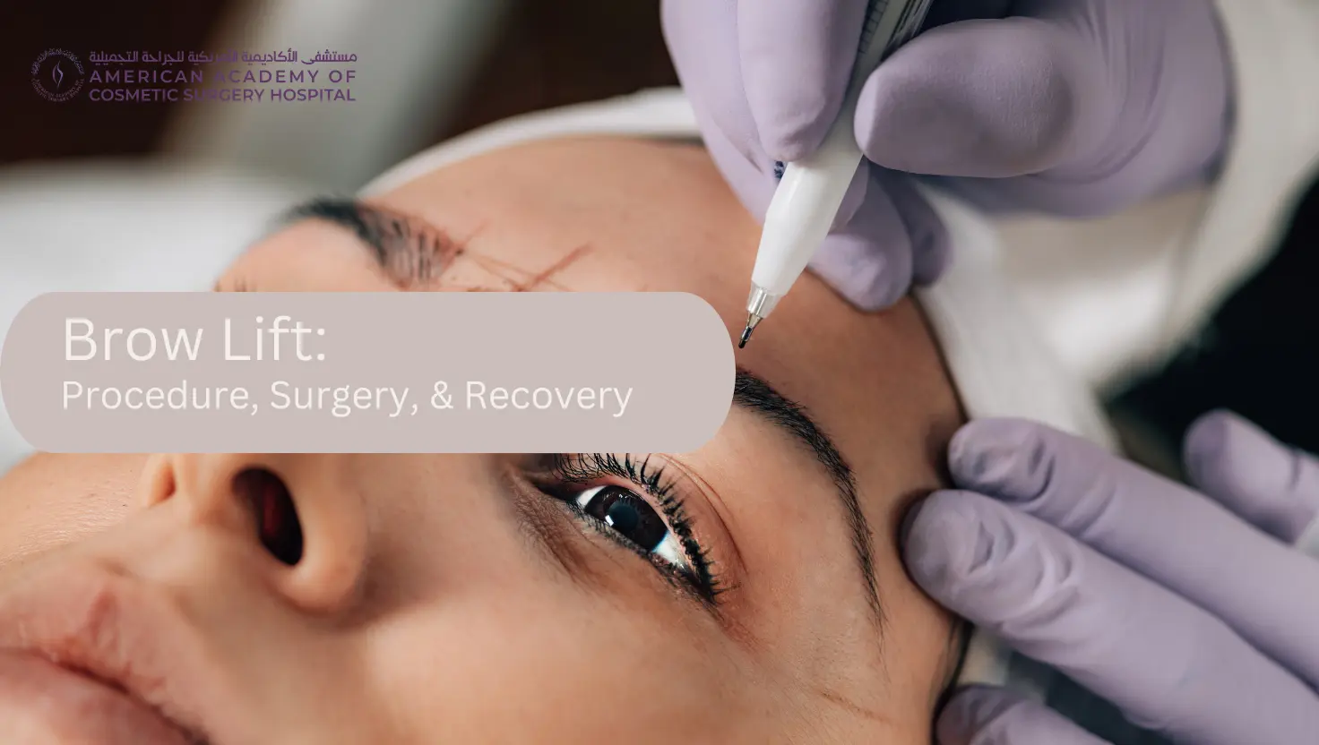 American Academy of Cosmetic Surgery Hospital | Brow Lift: Procedure, Surgery, & Recovery American Academy of Cosmetic Surgery Hospital | Brow Lift: Procedure, Surgery, & Recovery